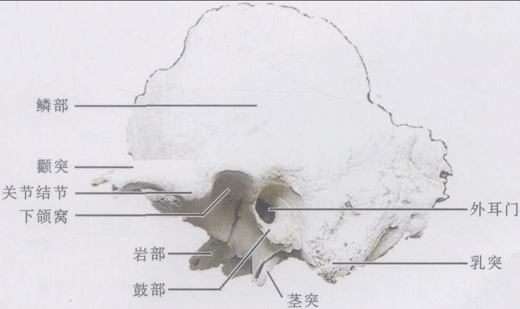 圖1-1-23 顳骨
